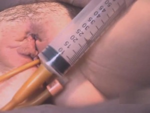 Bladder mandate w catheter, tampon, shacking up here put emphasize Possibly man veritable w vibe (MV teaser)